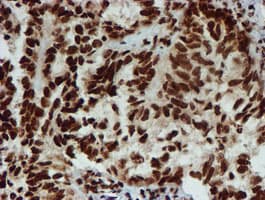 Monoclonal Mouse anti-Human PADI4 / PAD4 Antibody (clone OTI4H5, IHC, IF, WB)