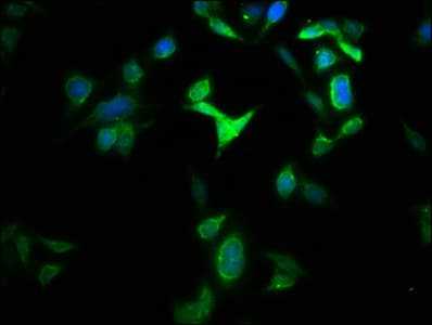 IHC-plus™ Polyclonal Rabbit anti-Human GLS2 / Glutaminase 2 Antibody (IHC)