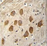 HCFC1R1 / HPIP Antibody (aa1-30)