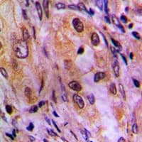 BABP / AKR1C2 Antibody (Internal)