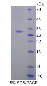 Mouse HAND1 Protein (Recombinant His-T7)