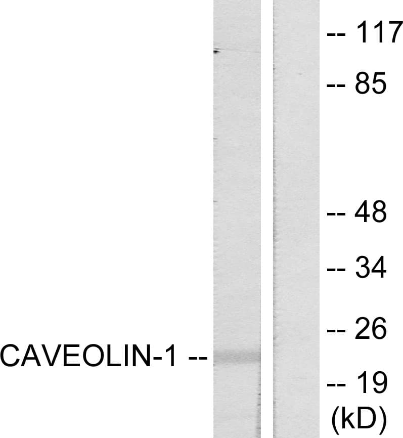 CAV1 / Caveolin 1 Antibody (aa5-54)