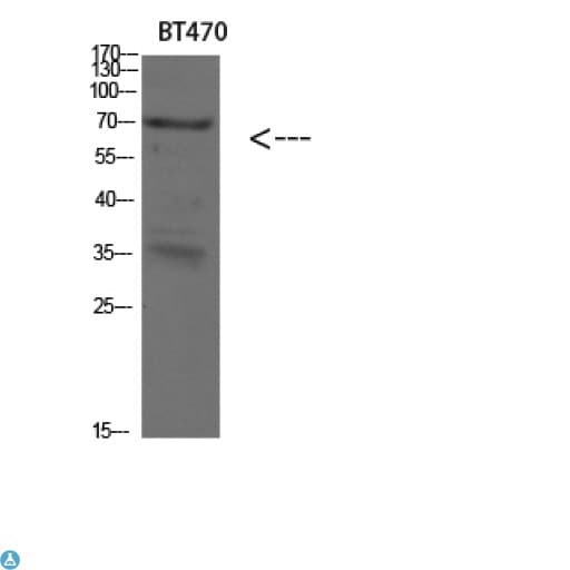 KRT4 / CK4 / Cytokeratin 4 Antibody