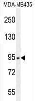ZBBX Antibody (aa34-62)
