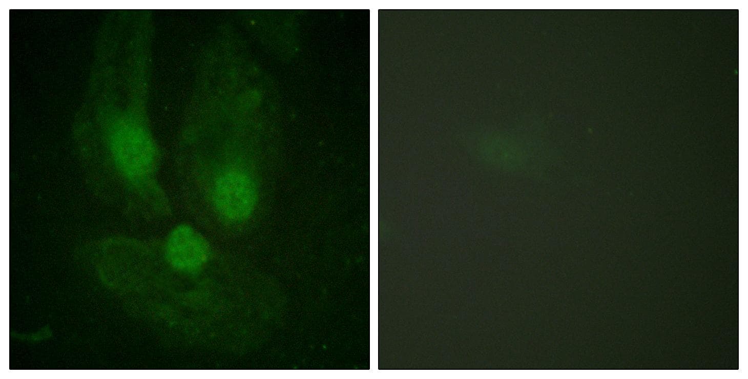 PRKCZ / PKC-Zeta Antibody (p410)