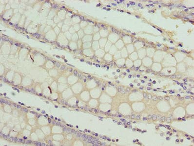 RAB3B Antibody