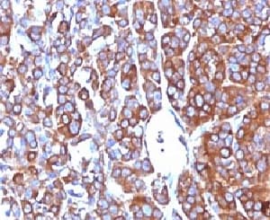 MSN / Moesin Antibody (clone MSN/492)