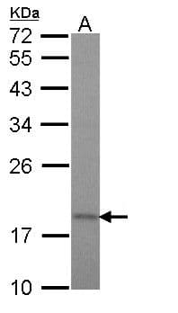 Polyclonal Rabbit anti-Human TIMM17A / TIM17 Antibody (aa108-171, WB)