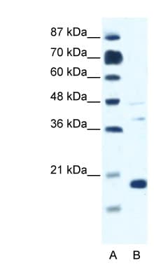 Polyclonal Rabbit anti-Human CACNG1 / CACNG Antibody (aa66-115, IHC, WB)