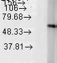 PathPlus™ HSPD1 / HSP60 Antibody