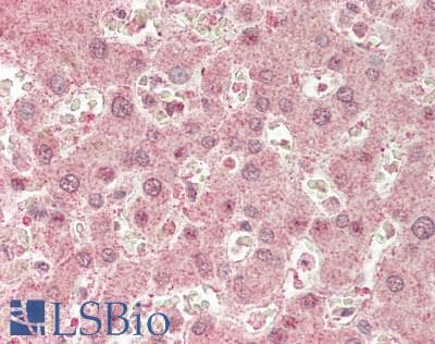 IHC-plus™ CACNB2 Antibody (clone 6C1)