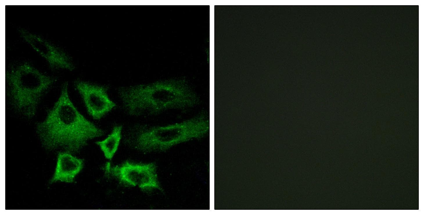 NT5C1A / CN1A Antibody