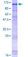 Human ERCC3 / XPB Protein (Recombinant GST)