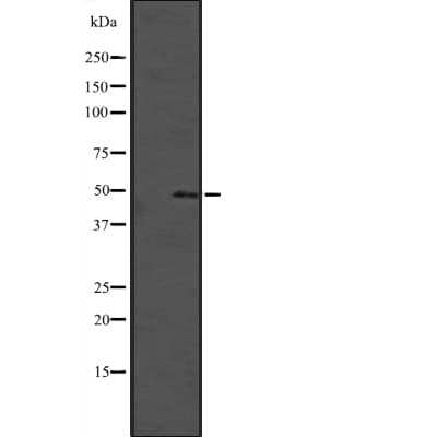 Polyclonal Rabbit anti-Human SOX4 Antibody (WB)
