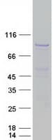 Human HDAC9 Protein (Recombinant Myc-DDK (Flag))