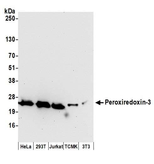 PathPlus™ PRDX3 / Peroxiredoxin 3 Antibody (aa206-256)