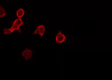 CMTM6 / CKLFSF6 Antibody