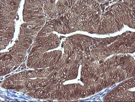 MAP2K1 / MKK1 / MEK1 Antibody (clone OTI2H3, Carrier-free)