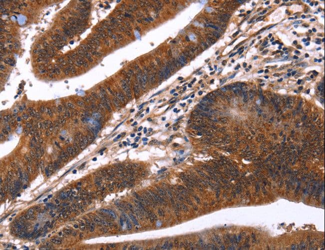 GUK1 / Guanylate Kinase 1 Antibody