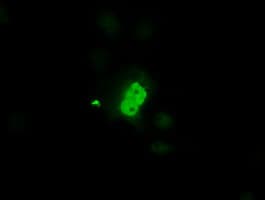 PIM2 / Pim-2 Antibody (clone OTI5B5)