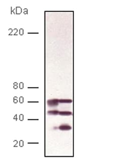 PPP3CA / CCN1 / Calcineurin A Antibody