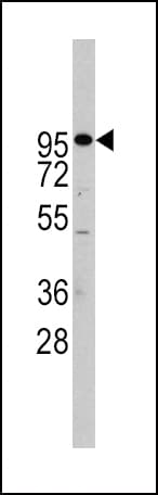 ADAM17 / TACE Antibody (aa794-823)