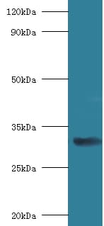 RPSA / Laminin Receptor Antibody