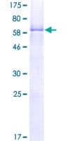 Human NKX2-1 / Thyroid-Specific TF Protein (Recombinant GST)