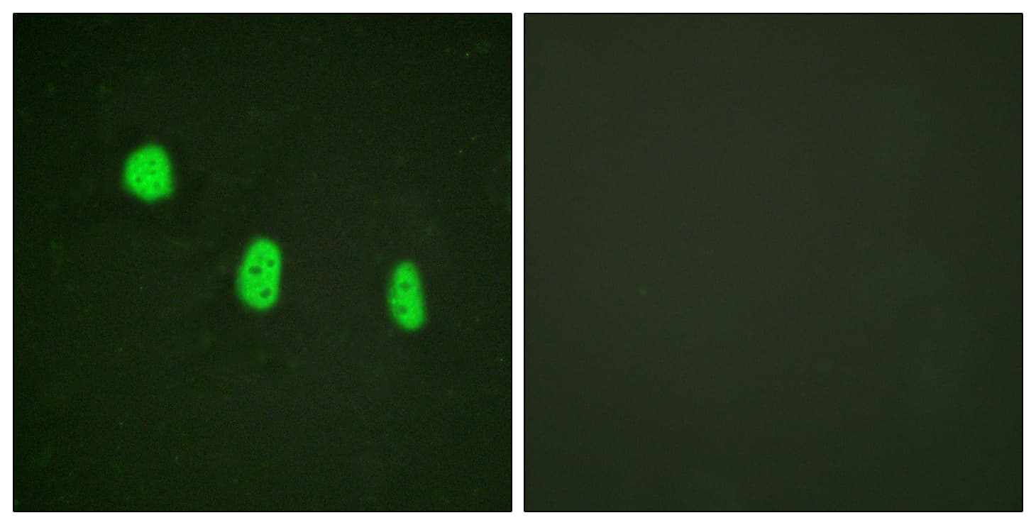 Polyclonal Rabbit anti-Human C/EBP Epsilon / CEBPE Antibody (phospho-Thr74, IHC, IF, WB)