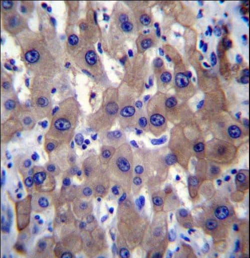 MLXIPL / CHREBP Antibody (aa624-653)