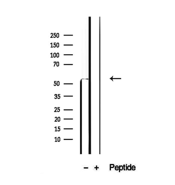 Polyclonal Rabbit anti-Human PDHX / Protein X / ProX Antibody (IHC, WB)