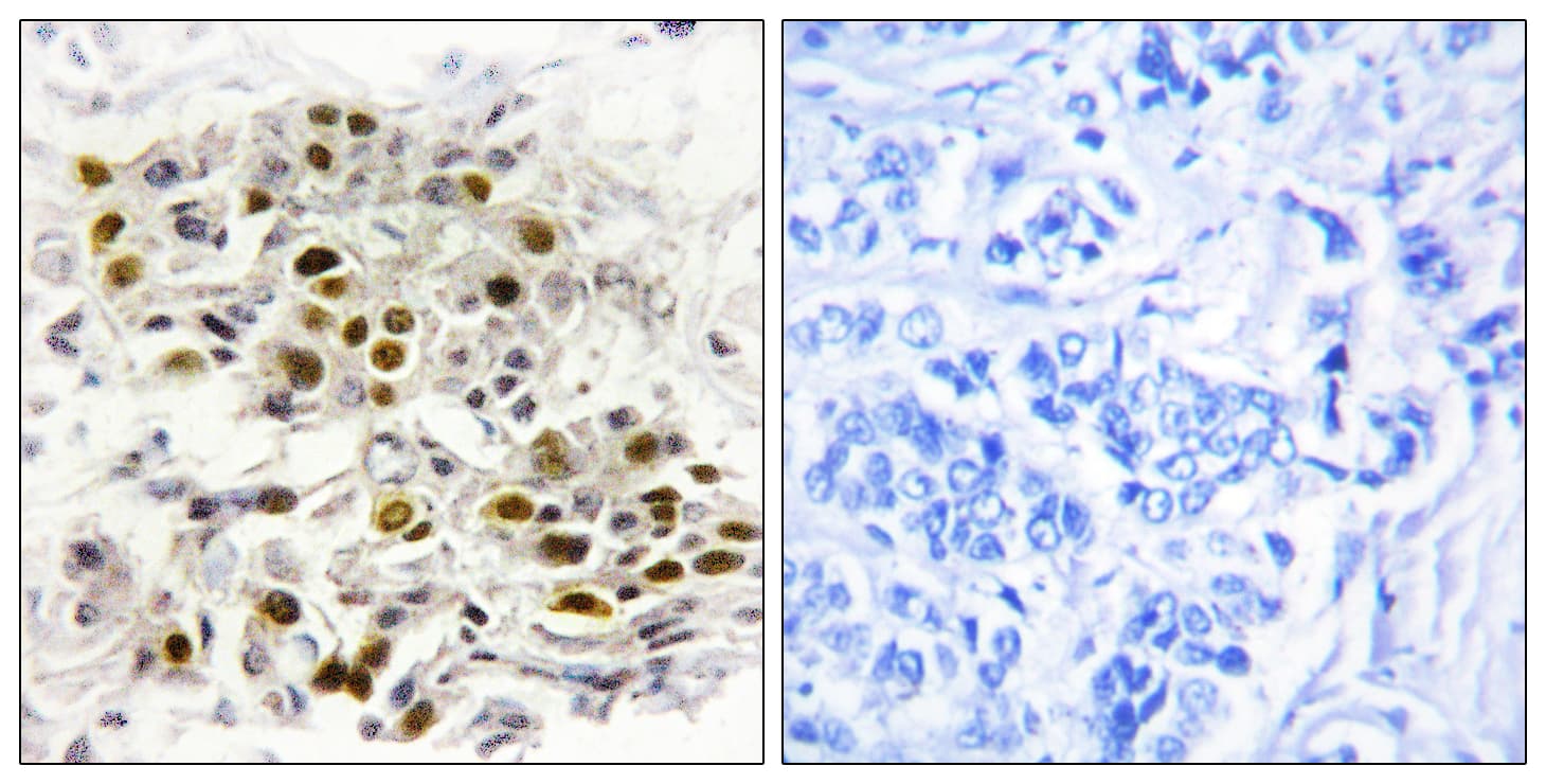 MAP3K6 / MEKK6 Antibody (aa281-330)