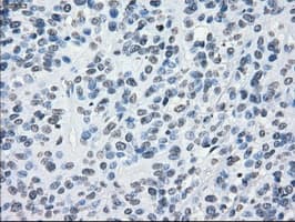 CRYAB / Alpha B Crystallin Antibody (clone OTI6G5)