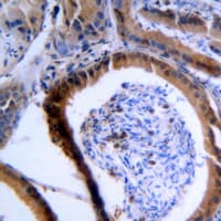VASP Antibody (Internal)