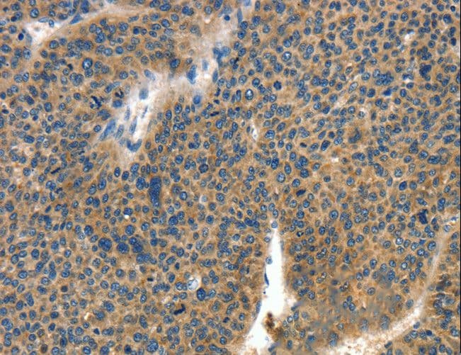 COL4A2 / Collagen IV Alpha2 Antibody