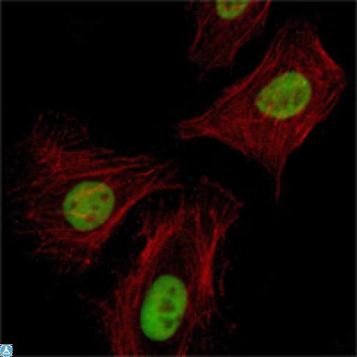 Monoclonal Mouse anti-Human RCHY1 / PIRH2 Antibody (IHC, IF, WB)