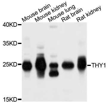 THY1 / CD90 Antibody