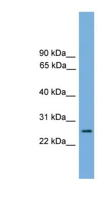 RAB35 Antibody (C-Terminus)