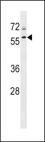 Polyclonal Rabbit anti-Human TBL1XR1 / TBLR1 Antibody (aa109-137, WB)