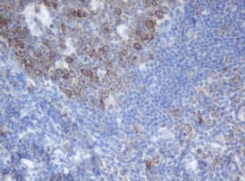 PAI-RBP1 / SERBP1 Antibody (aa1-262, clone OTI4F8, Carrier-free)
