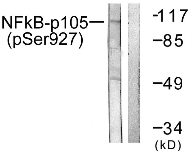 NFKB1 / NF-Kappa-B Antibody (phospho-Ser927)