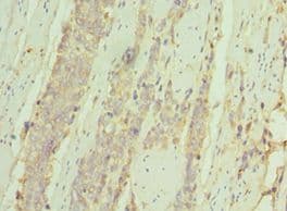 Polyclonal Rabbit anti-Human IL7R / CD127 Antibody (aa21-239, IHC, WB)