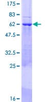 Human CDCA5 / Sororin Protein (Recombinant GST)