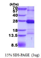 Human CD2 Protein (Recombinant His)