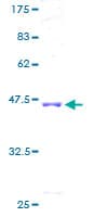 Human ADCK5 Protein (Recombinant GST)