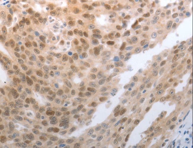 SLC22A8 / OAT3 Antibody