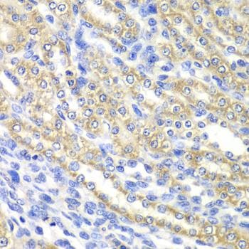 Polyclonal Rabbit anti-Human SURF1 Antibody (IHC)