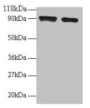 IHC-plus™ Polyclonal Rabbit anti-Human SAT1 / SAT Antibody (aa5-171, IHC, WB)
