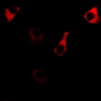 RPS14 / Ribosomal Protein S14 Antibody