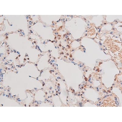 ADD1 / Adducin Alpha Antibody (phospho-Ser726)